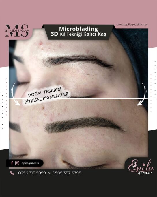 Nazilli - Microblading 3D Kıl Tekniği Kalıcı Kaş Kontürü