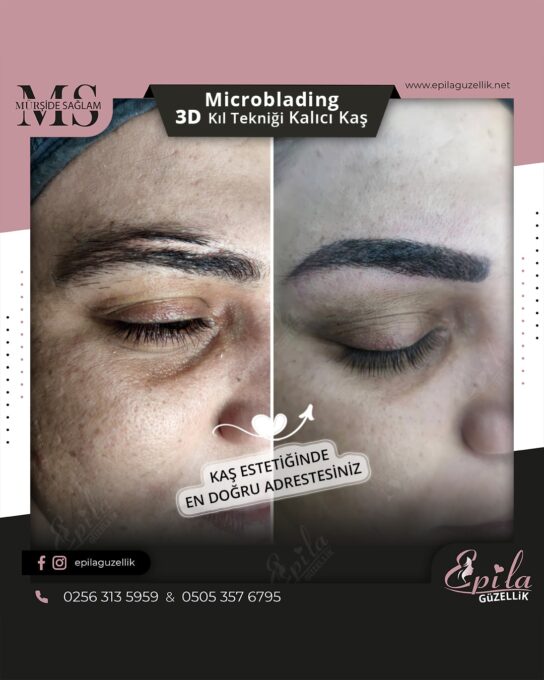 Nazilli - Microblading 3D Kıl Tekniği Kalıcı Kaş Kontürü