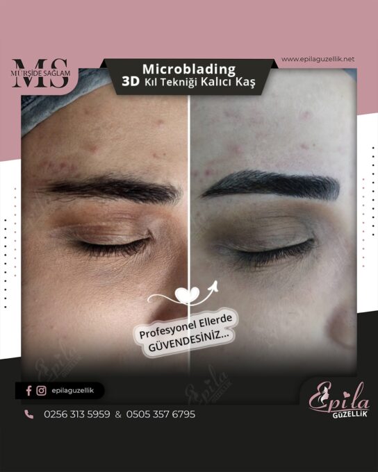 Nazilli - Microblading 3D Kıl Tekniği Kalıcı Kaş Kontürü