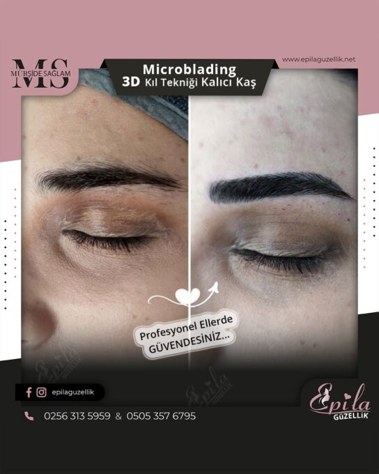 Nazilli - Microblading 3D Kıl Tekniği Kalıcı Kaş Kontürü