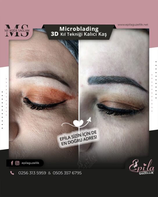 Nazilli - Microblading 3D Kıl Tekniği Kalıcı Kaş Kontürü