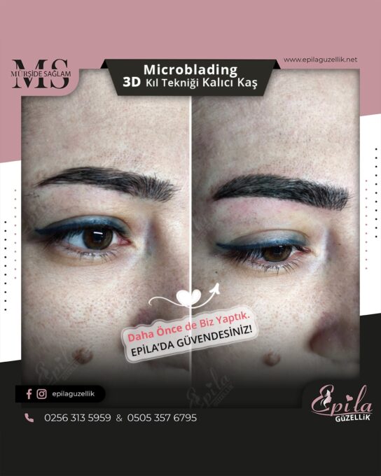 Nazilli - Microblading 3D Kıl Tekniği Kalıcı Kaş Kontürü