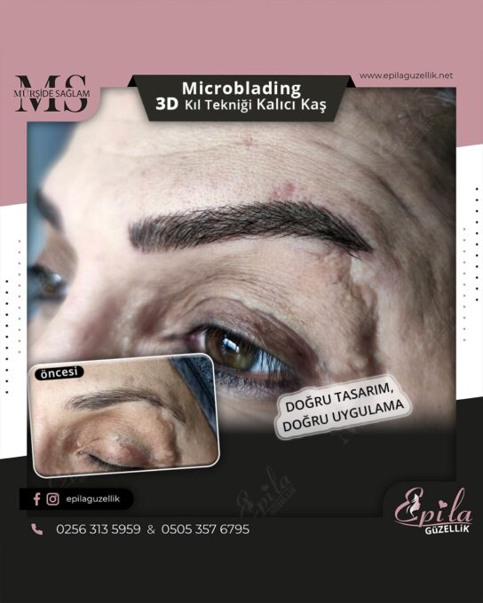 Nazilli - Microblading 3D Kıl Tekniği Kalıcı Kaş Kontürü