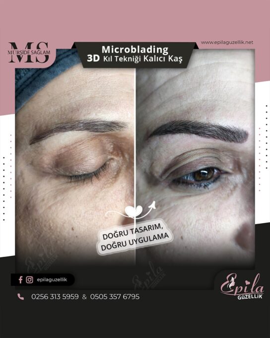 Nazilli - Microblading 3D Kıl Tekniği Kalıcı Kaş Kontürü