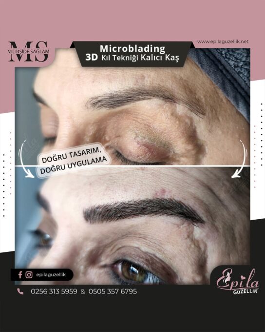 Nazilli - Microblading 3D Kıl Tekniği Kalıcı Kaş Kontürü