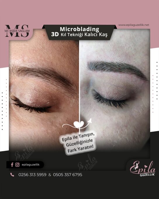 Nazilli - Microblading 3D Kıl Tekniği Kalıcı Kaş Kontürü