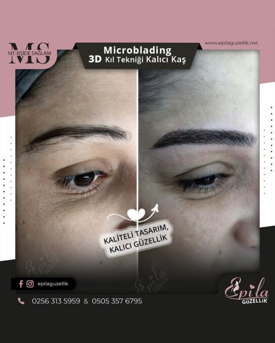 Nazilli - Microblading 3D Kıl Tekniği Kalıcı Kaş Kontürü