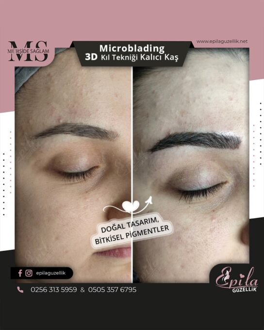 Nazilli - Microblading 3D Kıl Tekniği Kalıcı Kaş Kontürü