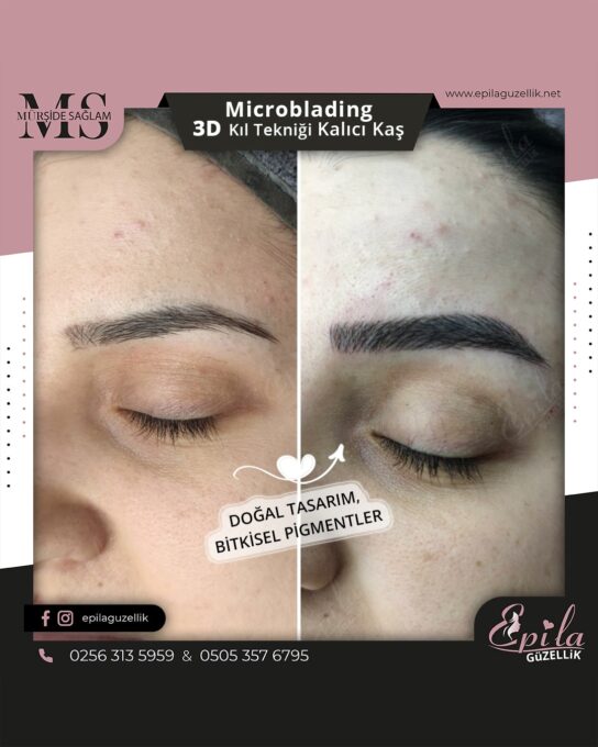 Nazilli - Microblading 3D Kıl Tekniği Kalıcı Kaş Kontürü