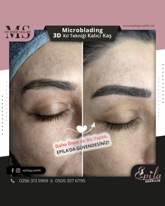 Nazilli - Microblading 3D Kıl Tekniği Kalıcı Kaş Kontürü