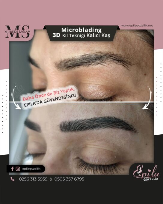 Nazilli - Microblading 3D Kıl Tekniği Kalıcı Kaş Kontürü