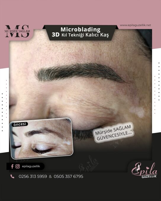 Nazilli - Microblading 3D Kıl Tekniği Kalıcı Kaş Kontürü