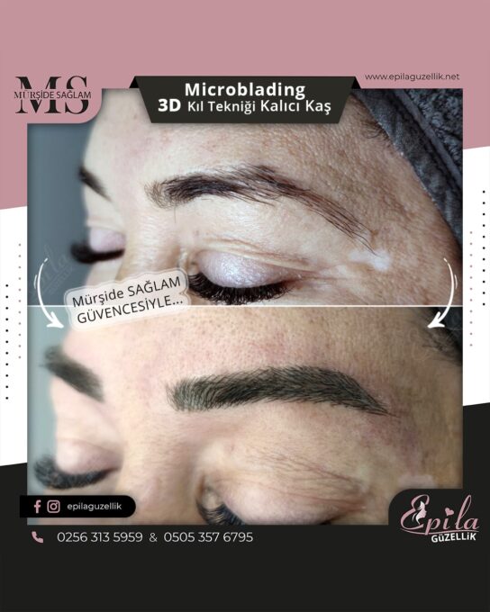 Nazilli - Microblading 3D Kıl Tekniği Kalıcı Kaş Kontürü