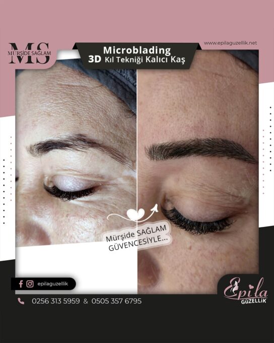 Nazilli - Microblading 3D Kıl Tekniği Kalıcı Kaş Kontürü