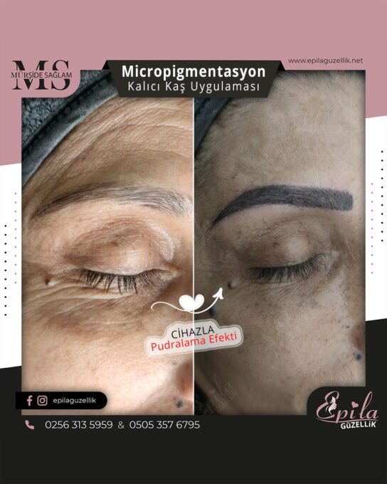 Nazilli - Microblading 3D Kıl Tekniği Kalıcı Kaş Kontürü