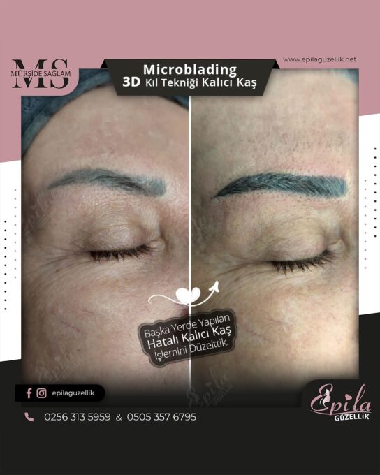 Nazilli - Microblading 3D Kıl Tekniği Kalıcı Kaş Kontürü