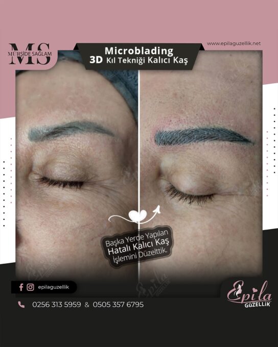 Nazilli - Microblading 3D Kıl Tekniği Kalıcı Kaş Kontürü