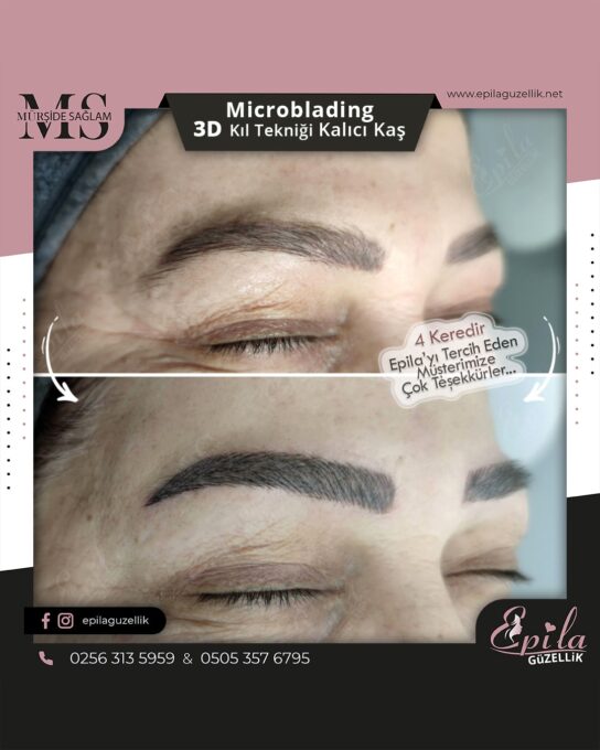 Nazilli - Microblading 3D Kıl Tekniği Kalıcı Kaş Kontürü