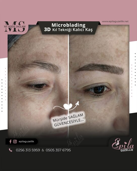 Nazilli - Microblading 3D Kıl Tekniği Kalıcı Kaş Kontürü