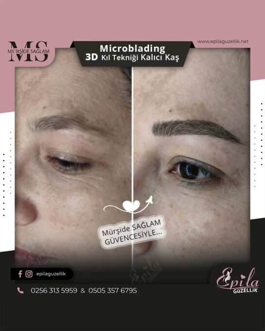 Nazilli - Microblading 3D Kıl Tekniği Kalıcı Kaş Kontürü