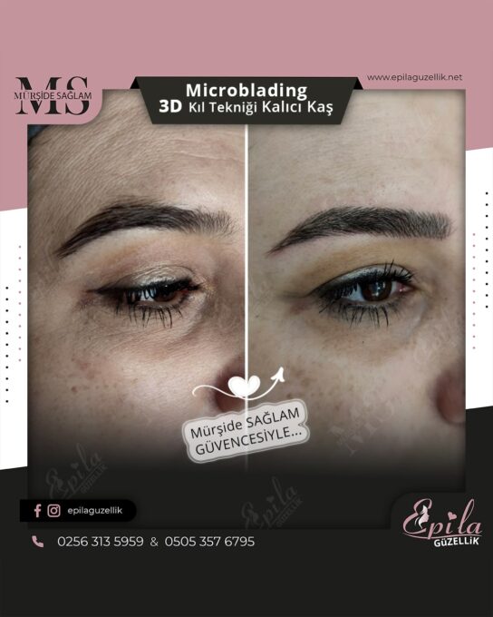 Nazilli - Microblading 3D Kıl Tekniği Kalıcı Kaş Kontürü