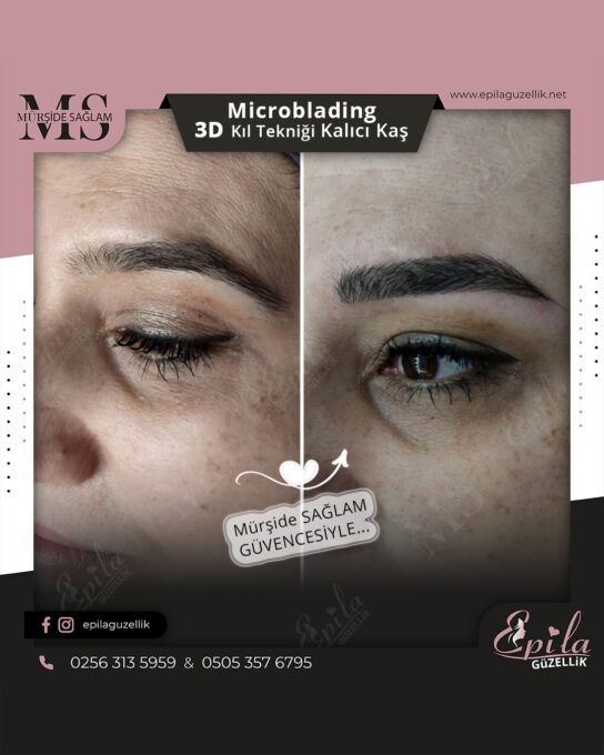 Nazilli - Microblading 3D Kıl Tekniği Kalıcı Kaş Kontürü