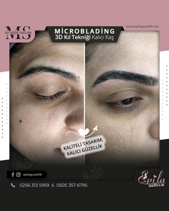 Nazilli - Microblading 3D Kıl Tekniği Kalıcı Kaş Kontürü