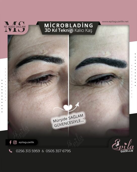 Nazilli - Microblading 3D Kıl Tekniği Kalıcı Kaş Kontürü