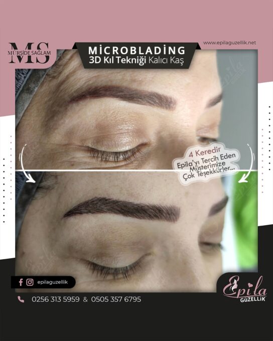 Nazilli - Microblading 3D Kıl Tekniği Kalıcı Kaş Kontürü