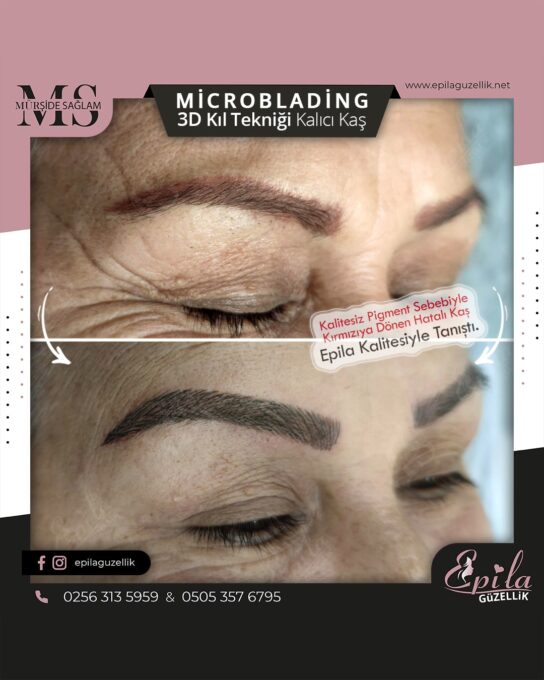 Nazilli - Microblading 3D Kıl Tekniği Kalıcı Kaş Kontürü