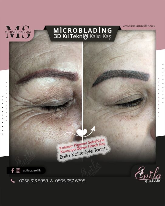 Nazilli - Microblading 3D Kıl Tekniği Kalıcı Kaş Kontürü