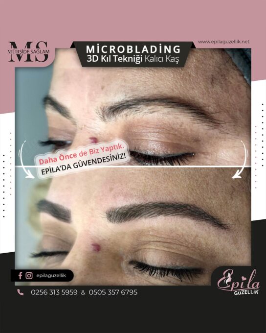 Nazilli - Microblading 3D Kıl Tekniği Kalıcı Kaş Kontürü