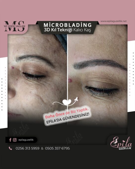 Nazilli - Microblading 3D Kıl Tekniği Kalıcı Kaş Kontürü