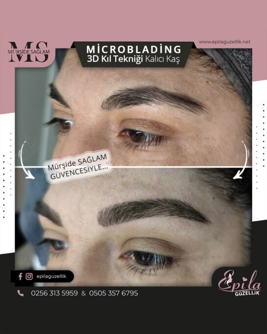 Nazilli - Microblading 3D Kıl Tekniği Kalıcı Kaş Kontürü