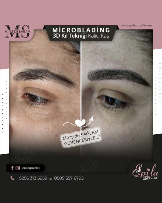 Nazilli - Microblading 3D Kıl Tekniği Kalıcı Kaş Kontürü