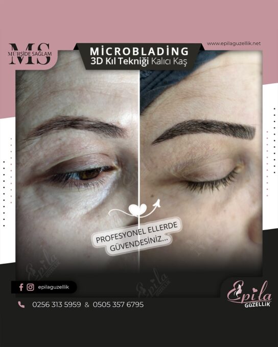 Nazilli - Microblading 3D Kıl Tekniği Kalıcı Kaş Kontürü