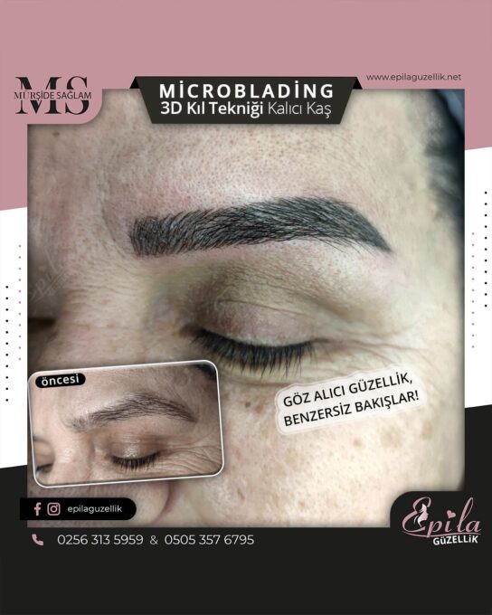 Nazilli - Microblading 3D Kıl Tekniği Kalıcı Kaş Kontürü