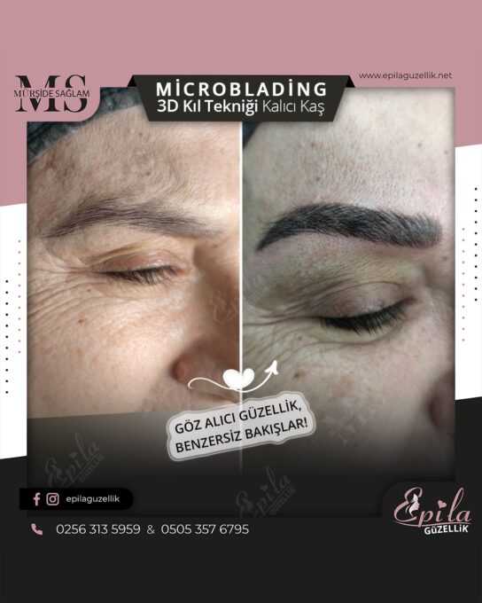 Nazilli - Microblading 3D Kıl Tekniği Kalıcı Kaş Kontürü