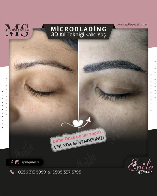 Nazilli - Microblading 3D Kıl Tekniği Kalıcı Kaş Kontürü