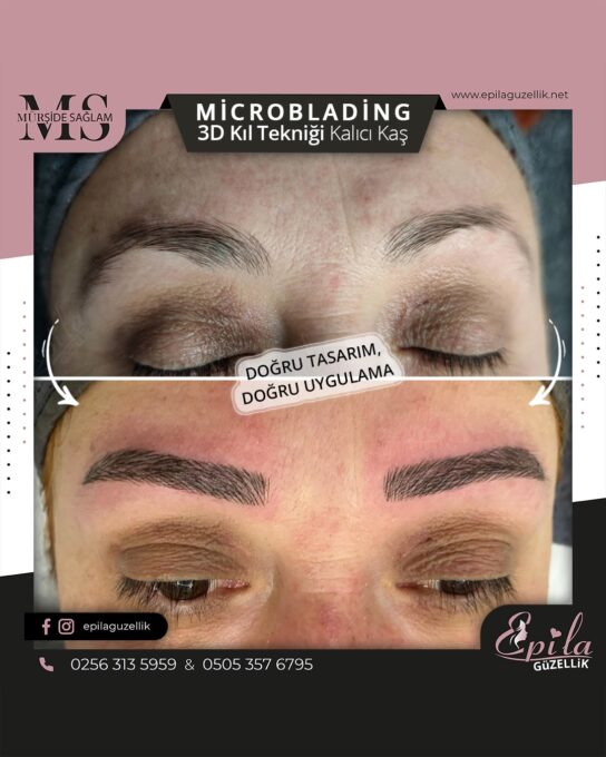 Nazilli - Microblading 3D Kıl Tekniği Kalıcı Kaş Kontürü