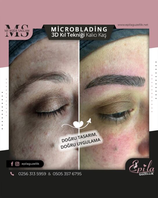 Nazilli - Microblading 3D Kıl Tekniği Kalıcı Kaş Kontürü