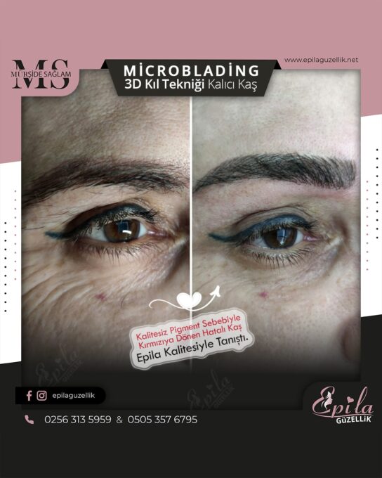 Nazilli - Microblading 3D Kıl Tekniği Kalıcı Kaş Kontürü