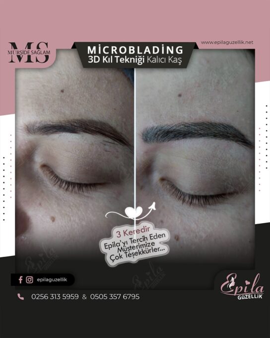 Nazilli - Microblading 3D Kıl Tekniği Kalıcı Kaş Kontürü