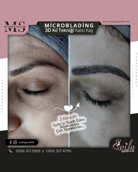 Nazilli - Microblading 3D Kıl Tekniği Kalıcı Kaş Kontürü