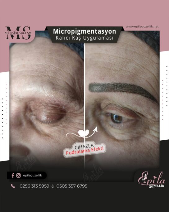 Nazilli - Microblading 3D Kıl Tekniği Kalıcı Kaş Kontürü