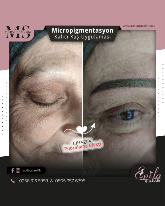 Nazilli - Microblading 3D Kıl Tekniği Kalıcı Kaş Kontürü