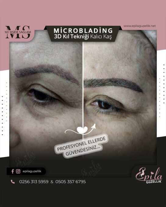 Nazilli - Microblading 3D Kıl Tekniği Kalıcı Kaş Kontürü