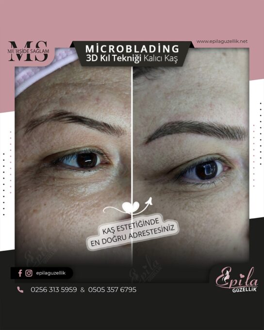 Nazilli - Microblading 3D Kıl Tekniği Kalıcı Kaş Kontürü