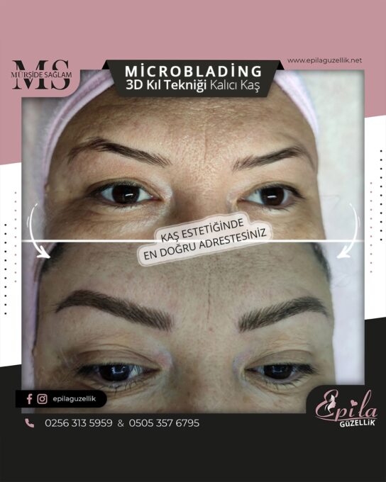 Nazilli - Microblading 3D Kıl Tekniği Kalıcı Kaş Kontürü