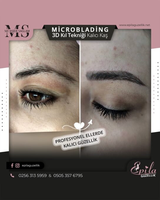 Nazilli - Microblading 3D Kıl Tekniği Kalıcı Kaş Kontürü